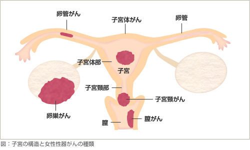 子宮の構造と女性性器がんの種類